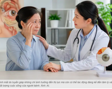 Bệnh mắt do tuyến giáp ảnh hưởng đến cuộc sống người bệnh như thế nào?